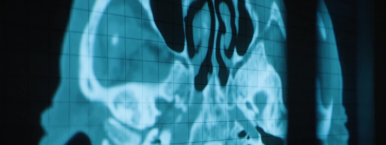 Results of a medical scan are displayed on a grid on a monitor