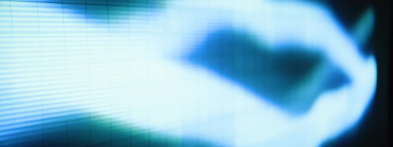 The projected animation on the wall is dots and moving strings