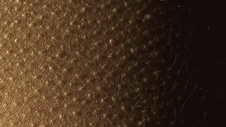 Goosebumps appear and then subside on the surface of skin