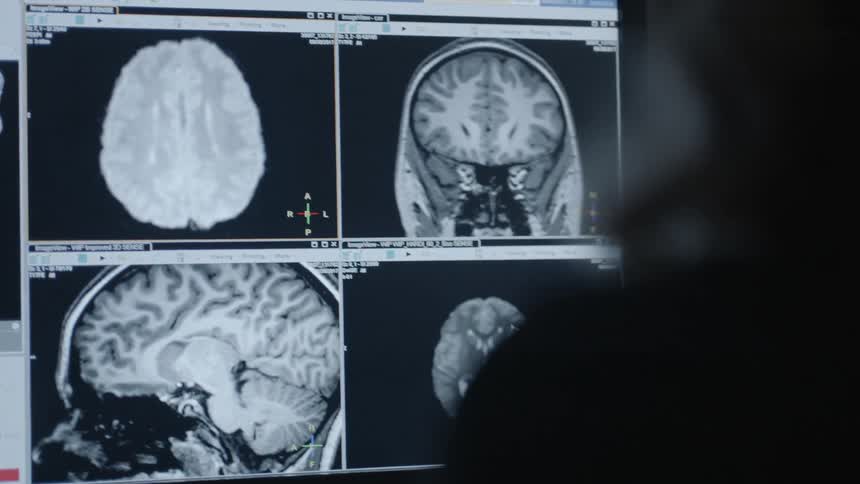 A person looks at brains on a screen