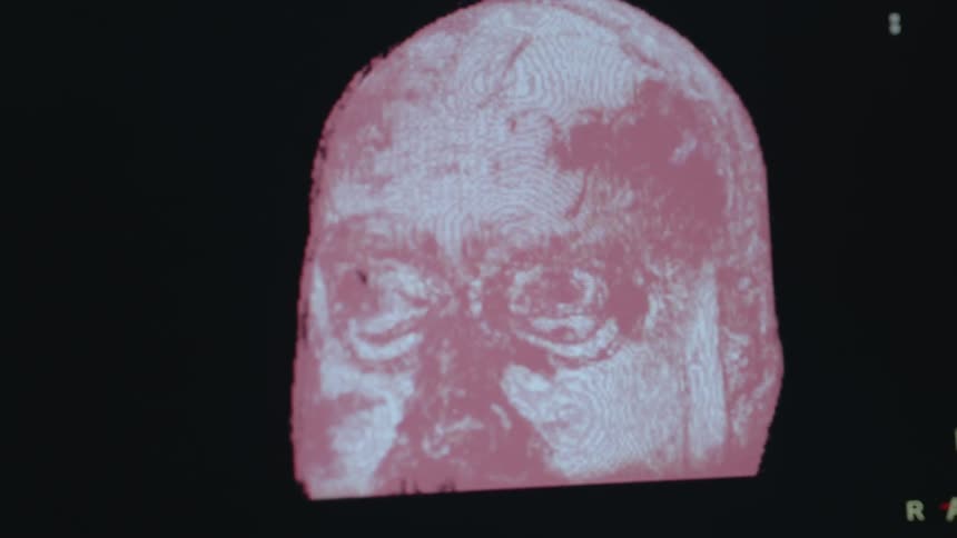 Computer generated image of a person's head