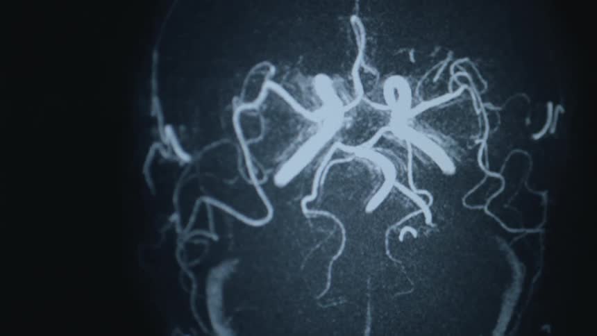 Computer generated image of a person's head