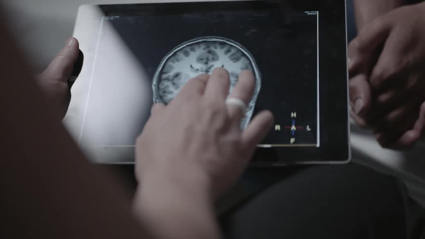 A person adjusts a picture of a brain on a tablet