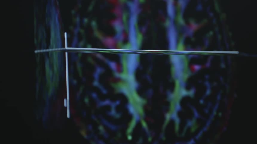 Close up of an image of a brain