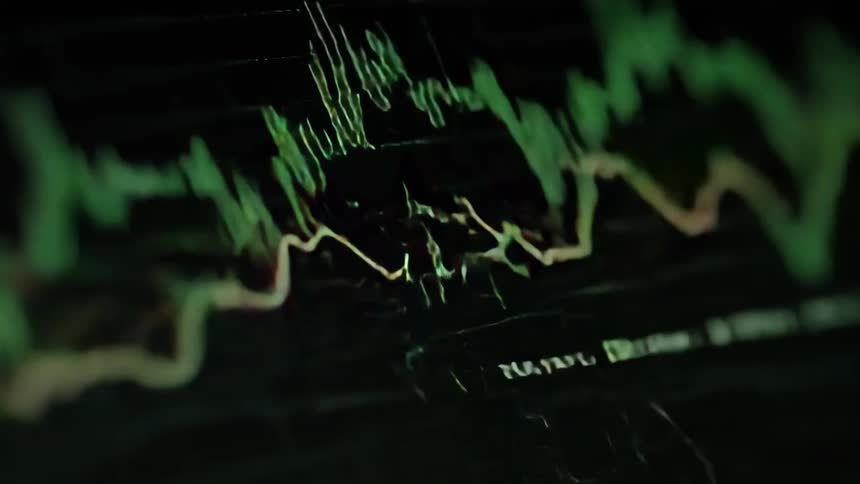 Close up of device screen displaying a trading interface with candlesticks and indicators over a dark background