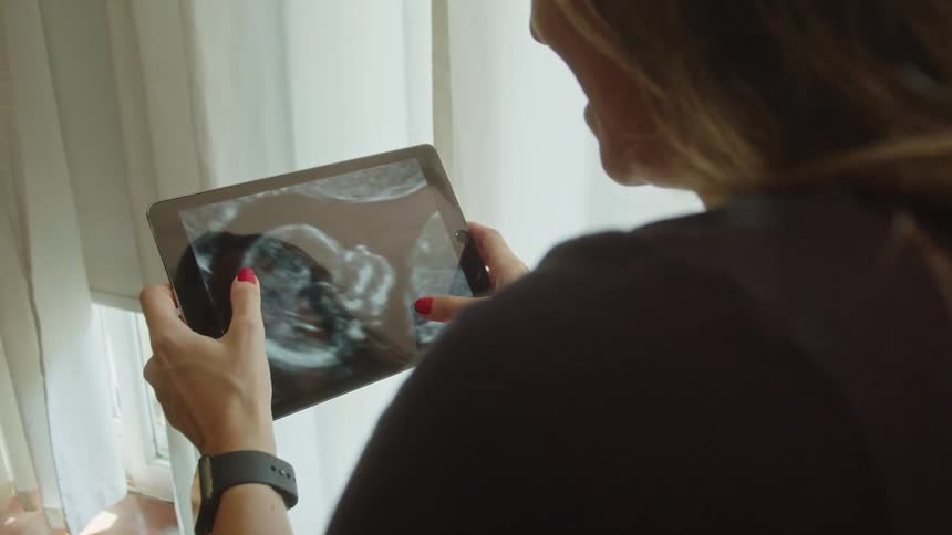 The woman touches the tablet with the ultrasound on display