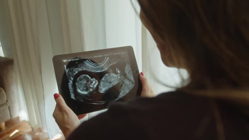 The woman is looking at an ultrasound on her tablet