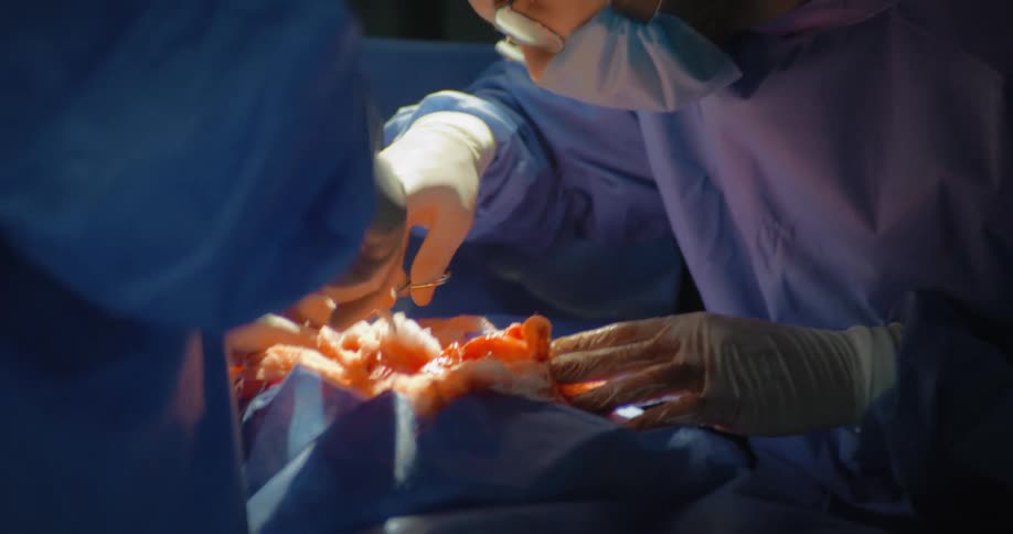 The nurse hands a surgical tool to the surgeon