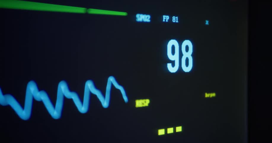 The monitor is displaying a pulse