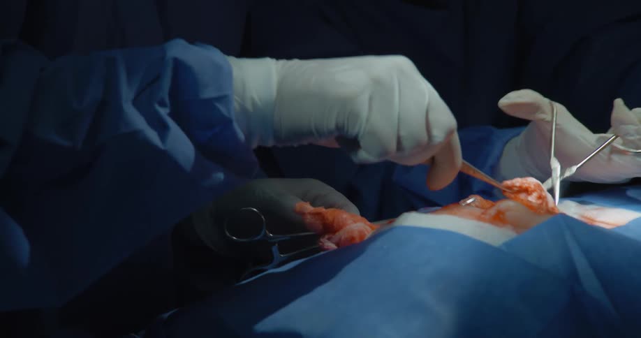 The patient is undergoing surgery