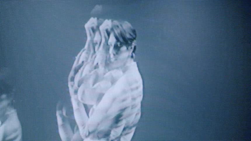 The video displays a glitchy monochromatic black and white closeup of a persons face with pixelation and visual distortion creating a digital or vintage television effect the face is predominantly shown in profile occasionally shifting to face for