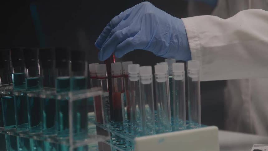 Lab technician doing research on speciman samples from test tubes