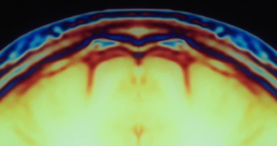 Colorful animated medical scan image moves against a black background