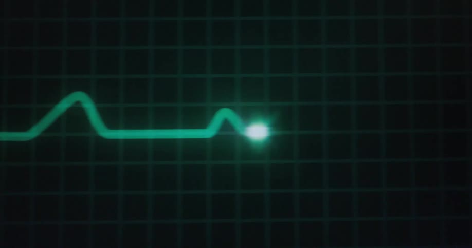 A digital graphic shows a green glowing line tracing a heartbeat rhythm on a black grid the line pulses and moves across the screen mimicking an ekg monitor