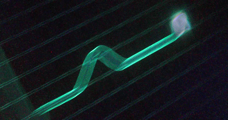 Electrocardiogram showing green neon lines with heartbeat pulses