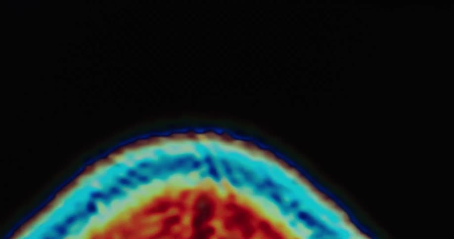 A colorful heatmap style image of a brain scan appears against a black background showing thermal or neural activity in vivid blue red and yellow hues