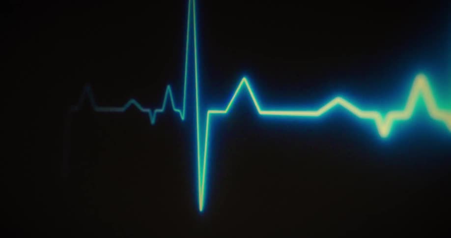 A waveform with a bright pulsing light moves across a dark screen