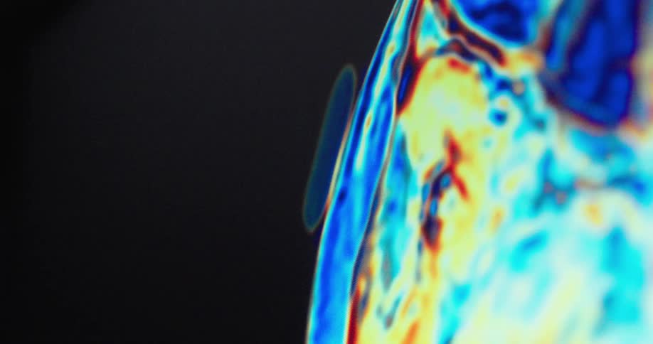 A thermal or mri scan of a persons body is shown with a focus on their head and spine the colors on the scan shift and move highlighting the different internal structures and their activity