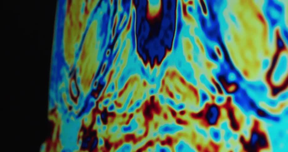 Moving colors of a medical scan image contrast with the black background