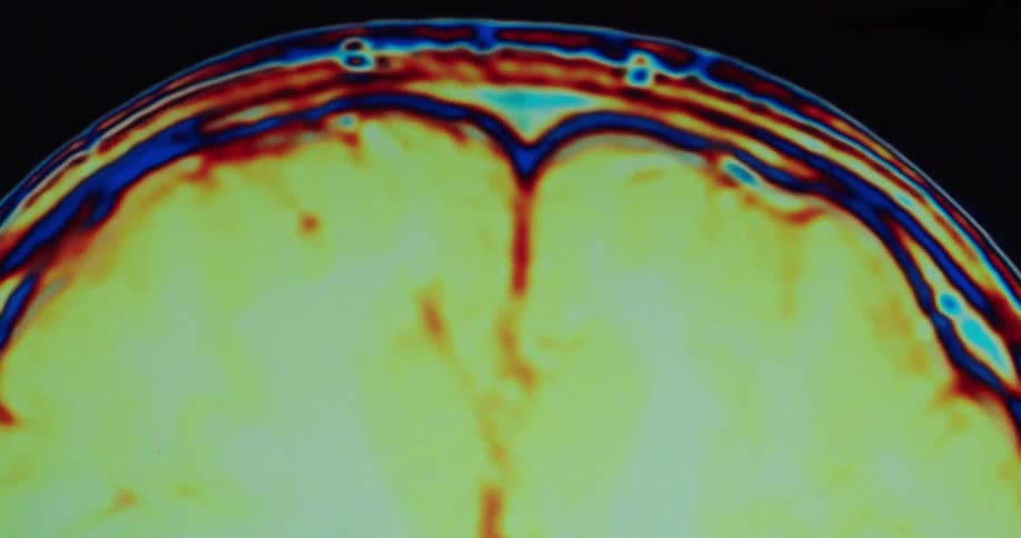 The imaging of a persons brain moves