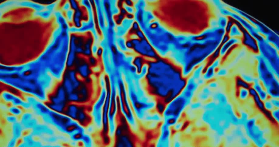 A colorful medical scan of a human head and brain rotates on a black background showing different cross sections with arteries and veins in red and blue