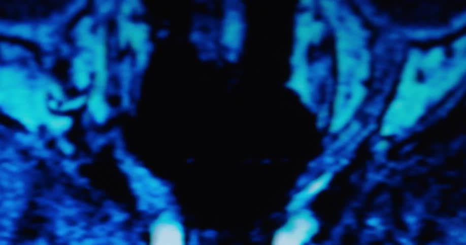 Blue animated medical scan image contrasts with a black background