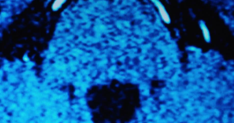 A blurry bluetinted medical scan reveals branching structures resembling blood vessels or neural pathways