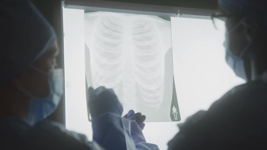 Two medical professionals discuss a chest x ray