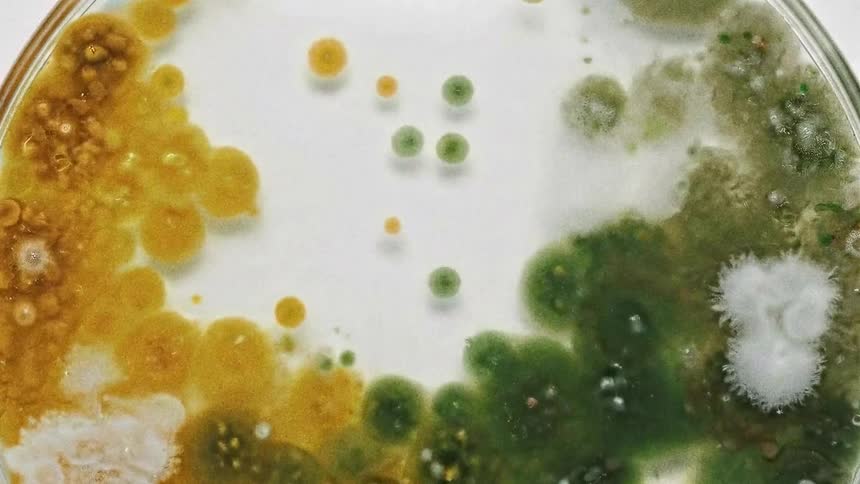 The organism grows in the petri dish