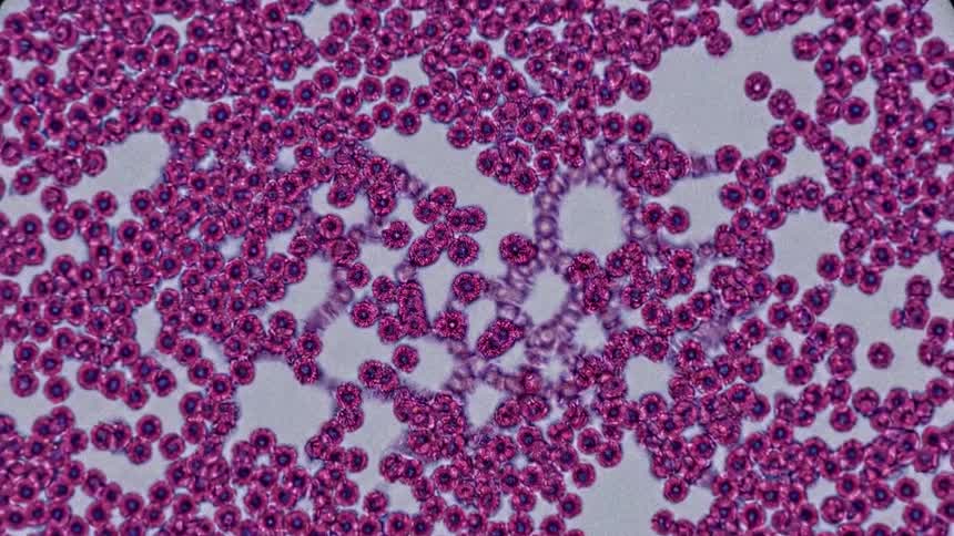 A microscopic shot of what appears to be blood cells which are moving and clumping together