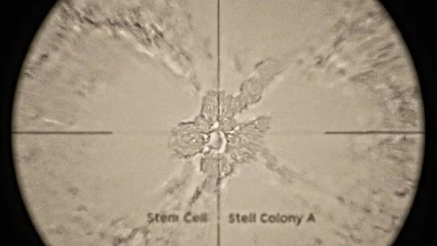 The video shows a timelapse of a scientific experiment in a lab viewed through a microscope over time several isolated stem cells multiply and cluster together forming intricate colonies