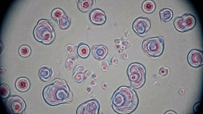 Cells observed on a slide under a microscope with pink and blue staining