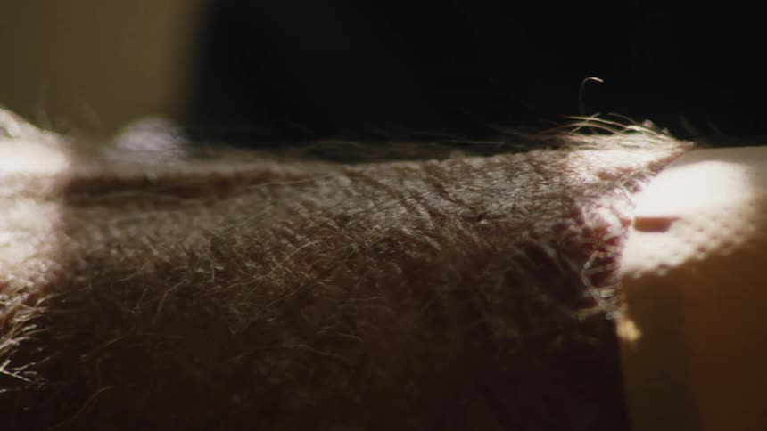 A closeup shows an elderly person hand with a bandage applied