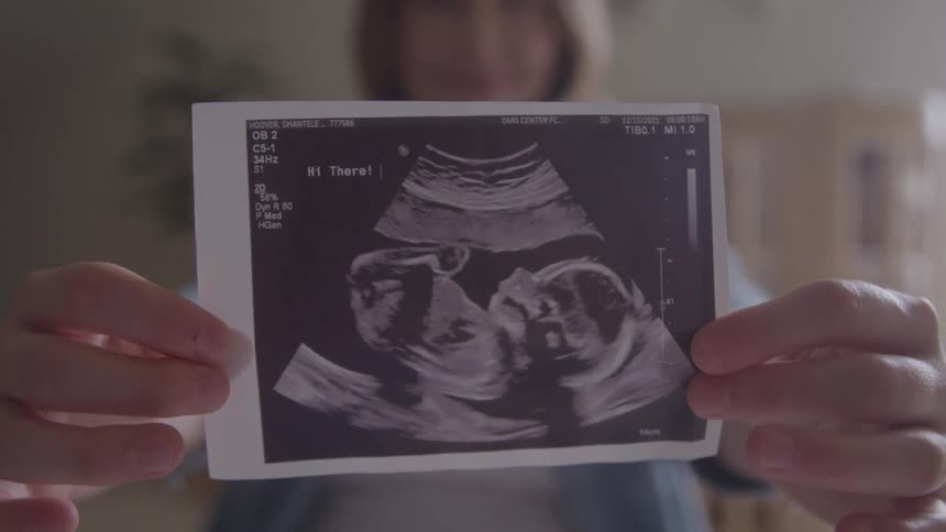 A smiling pregnant woman holds a sonogram printout in front of her slowly bringing the image into a sharp focus