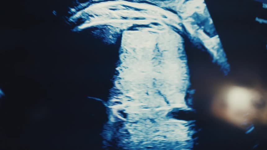 Ultrasound scan reveals details of the baby in the womb