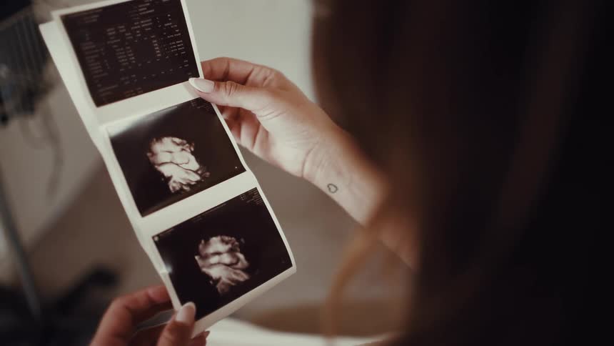 A woman holds printed ultrasound photos looking at clear images of the babys face
