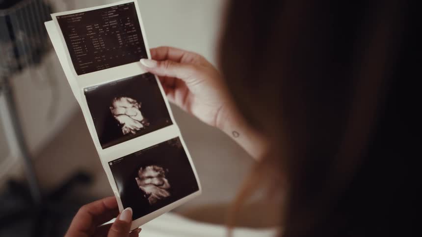 A woman holds a strip of ultrasound images likely from a prenatal scan