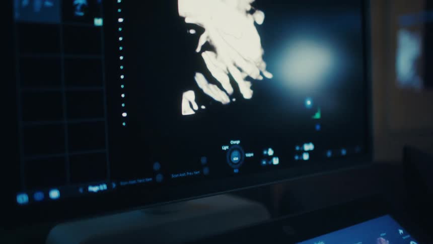 A closeup view shows medical imaging equipment with monitors displaying scans and control settings illuminated