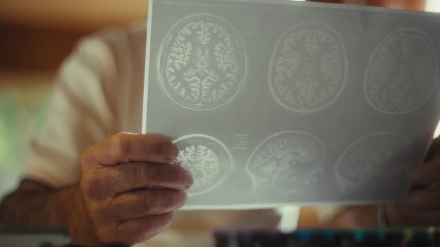 Person holds brain mri scans
