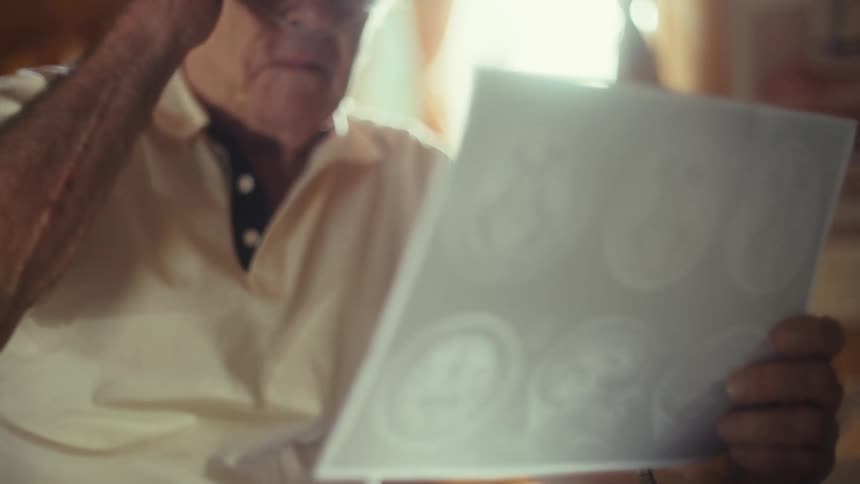 The man takes off his glasses while looking at a ct scan print out