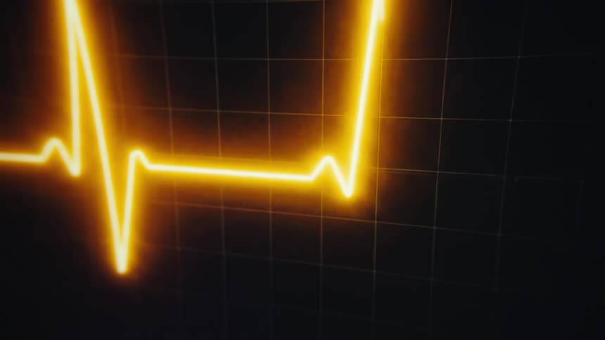 Cardiac event monitor displaying a yellow heartbeat line moving up and down on a dark screen