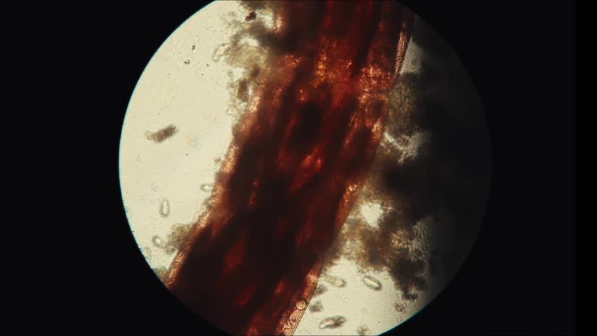A microscopic view shows a large central structure of dark reddish brown fibrous material surrounded by moving microorganisms and debris against a bright clear background