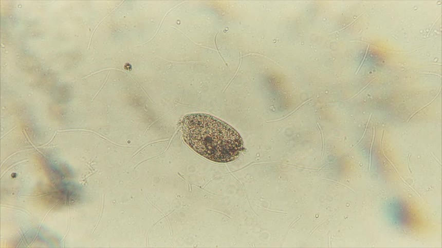 A speckled oval microorganism drifts on a pale field threaded with faint wavy filaments