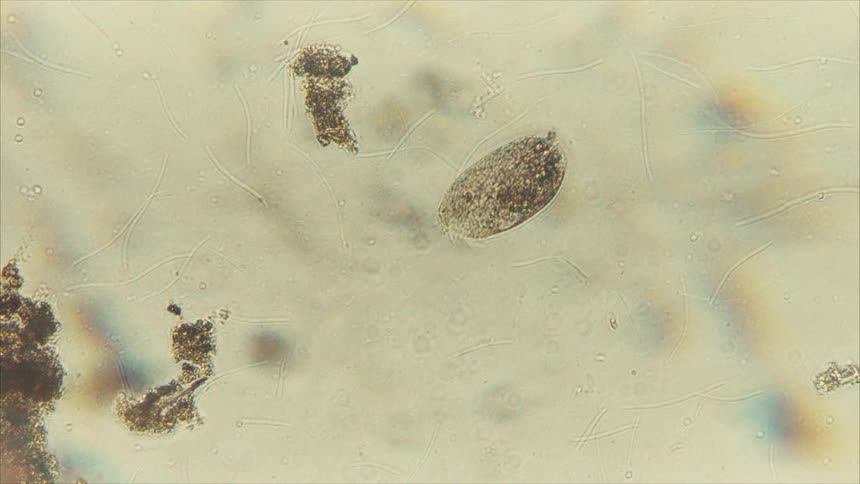 A microscopic view shows a large oval shaped ciliated protozoan moving slowly on a light beige background surrounded by clumps of dark debris and thin threadlike strands