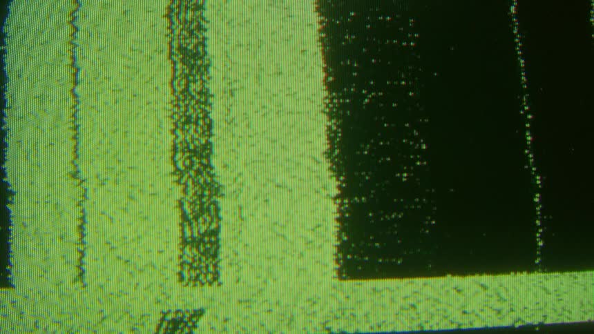 A close view of an old television screen shows bright green static and flickering digital noise that shifts to abstract patterns of black and green vertical bars with colorful distortion