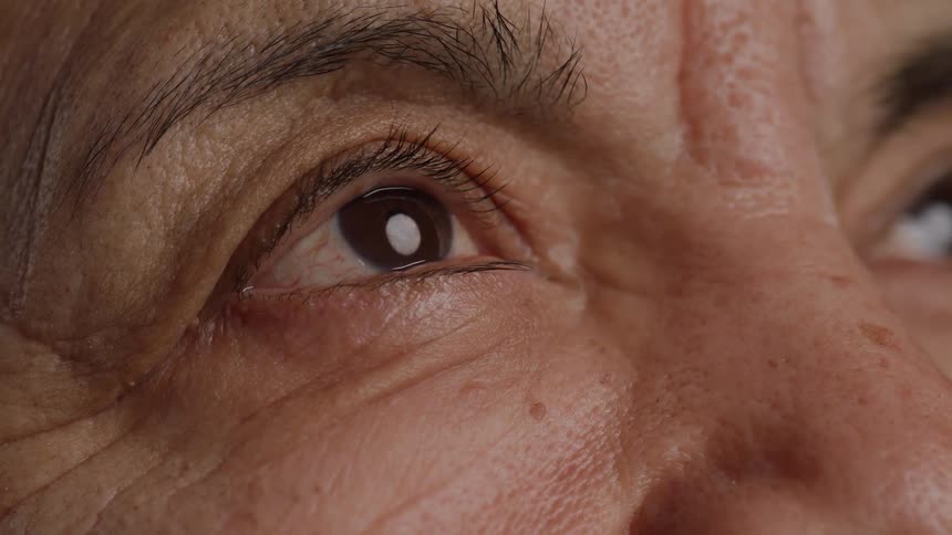An elderly person is looking up as they blink
