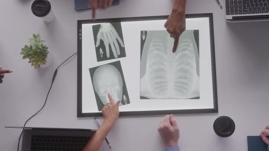 Women placing xrays in an xray view box and pointing at them