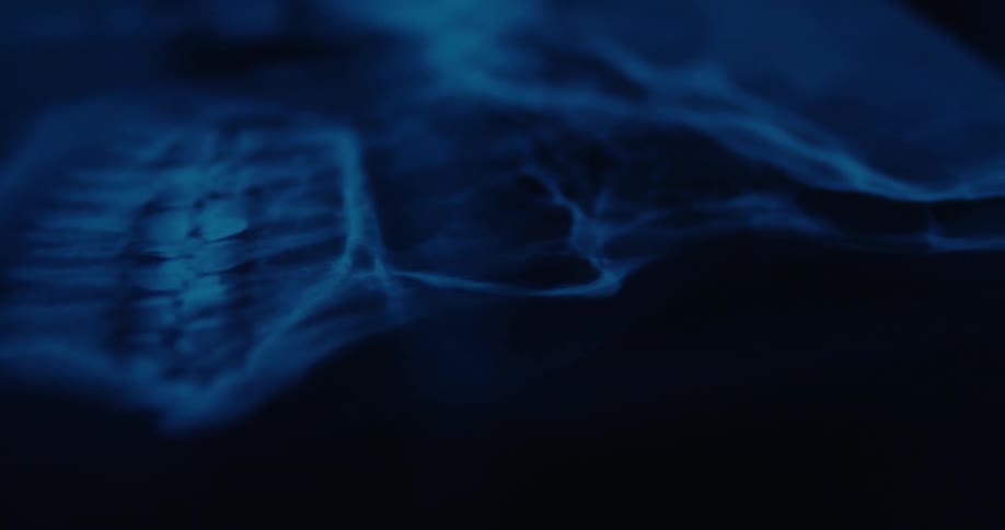 The x ray is of a head
