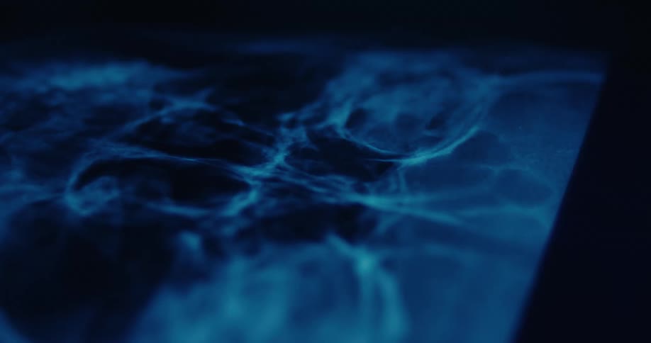 A close up view of x rays being taken