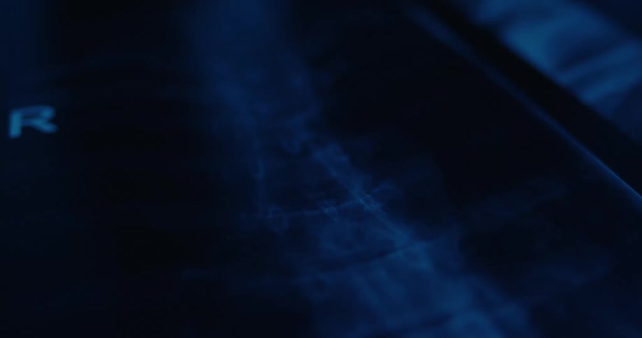 Spine in bluish xray with aligned vertebrae in focus